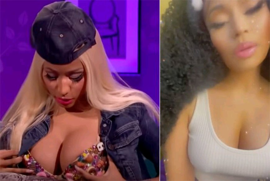 Fans Bash Nicki Minaj After Revealing She Went for Breast Reduction